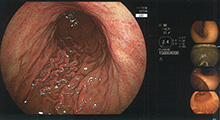 胃・大腸内視鏡検査